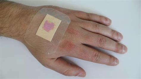 Your Health Partner Wound Dressing That Changes Colour To Indicate Wound Infected Designed By