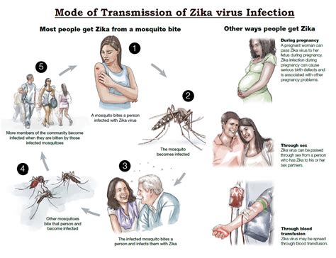 Zika Virus Disease